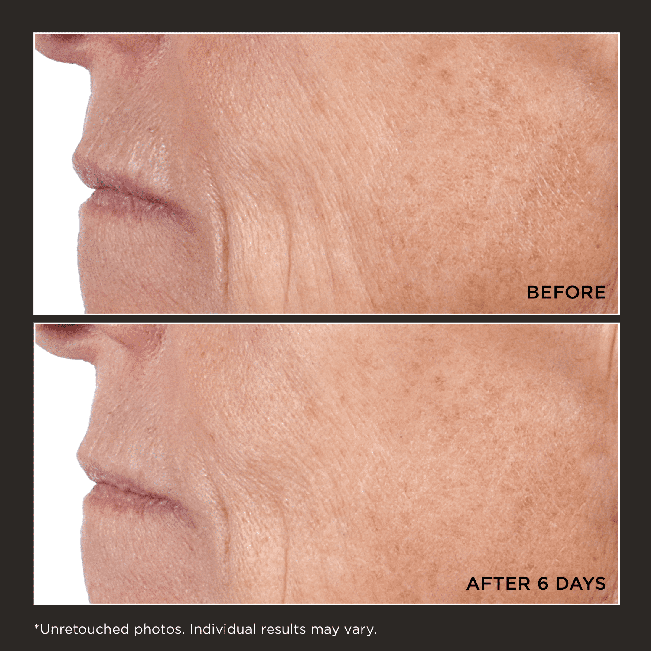 Perricone MD Cold Plasma Plus+ Concentrated Treatment Sheet Mask, 1 ct. - Image 3